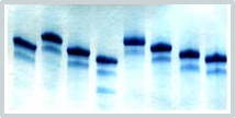 Molecular Diagnostic Products